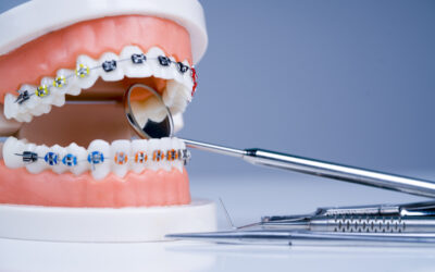 What Does an Orthodontist Do? A Timnath, CO Guide to Straighter Teeth and Better Bites