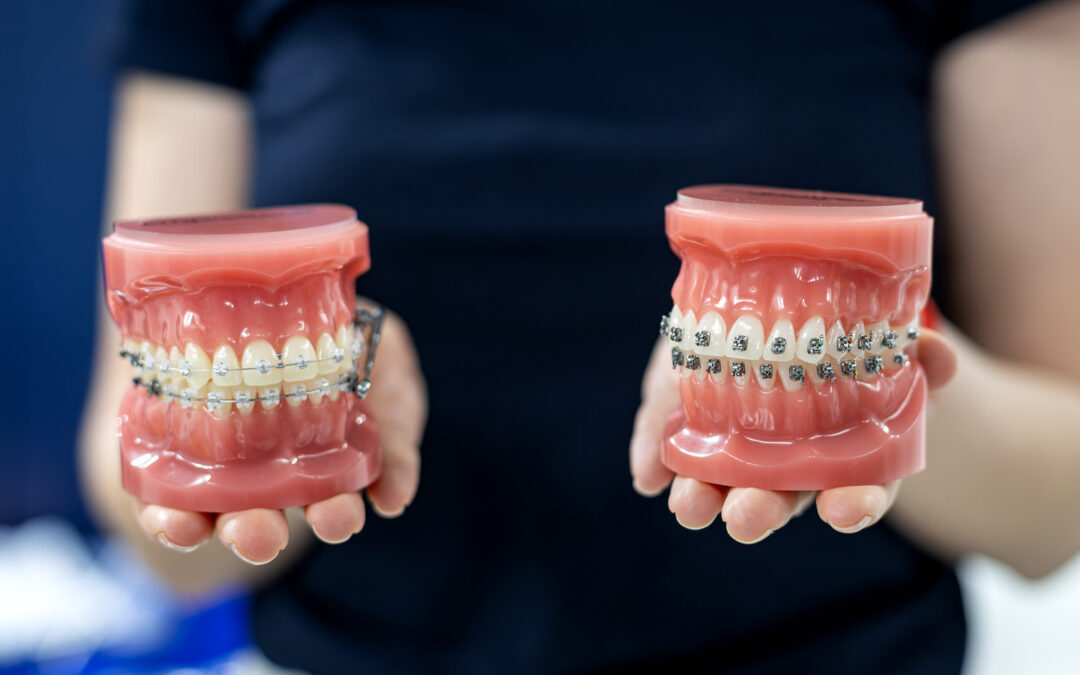 Orthodontist hold examples of orthodontic options including braces, ceramic braces, and invisalign, in Timnath CO